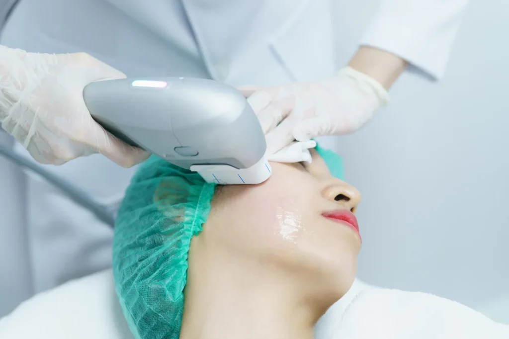 Ultraformer MPT | Dermatologista em Brasília LiLian Mendes Dermatologista - Ultraformer MPT